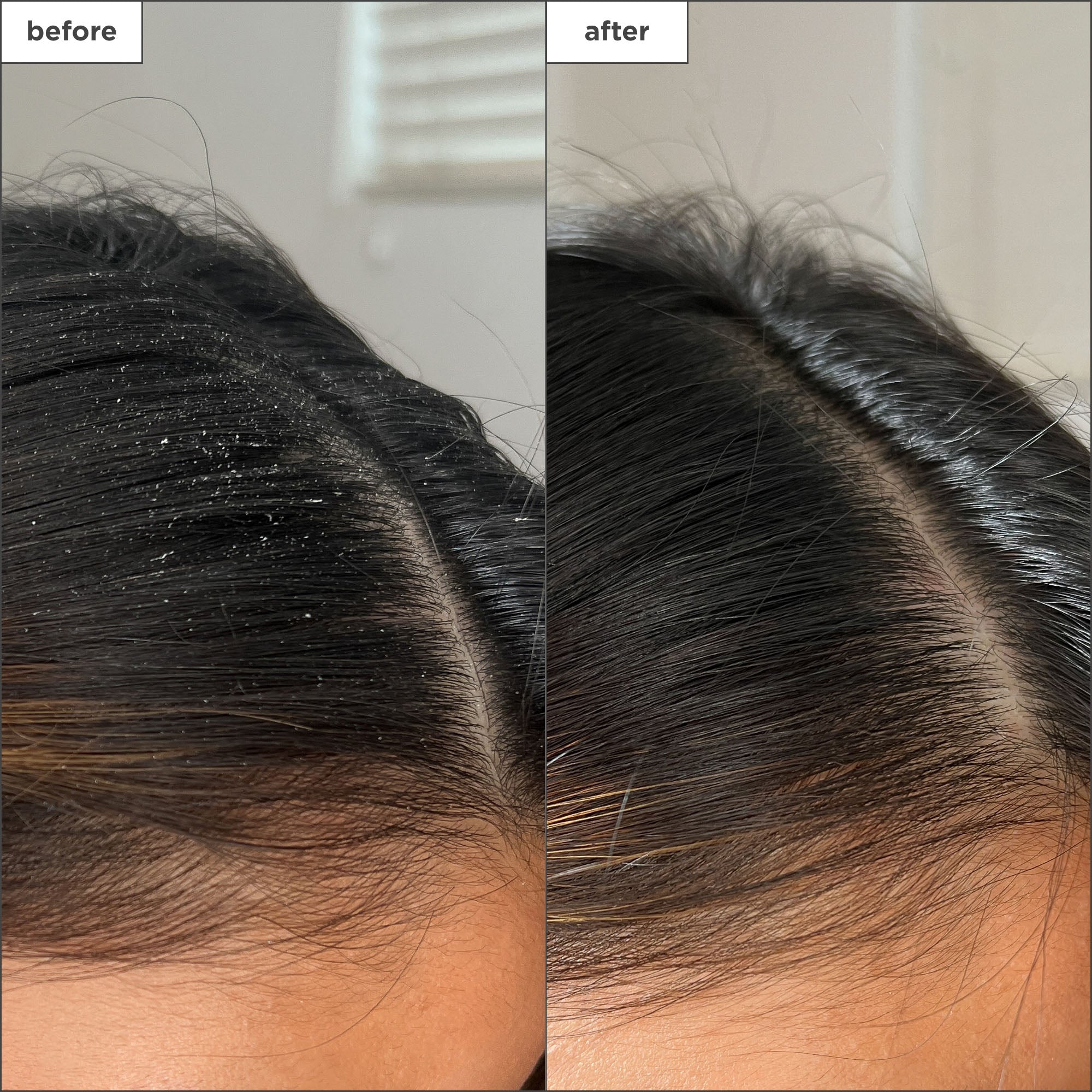 Scalp Revival Charcoal + Tea Tree Buildup Detox Spray - Briogeo